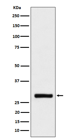 BRMS1 Rabbit mAb