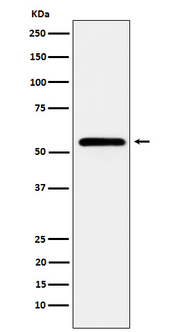 CaMKII Rabbit mAb