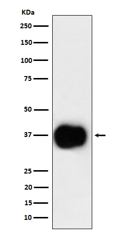 CD79b Rabbit mAb