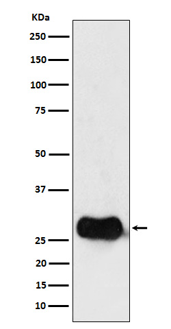 HLA DMB Rabbit mAb