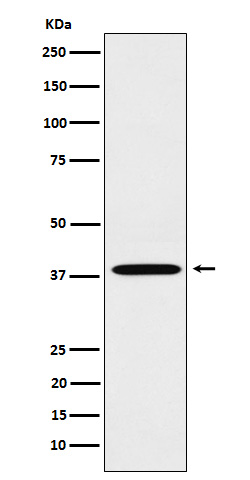 LTB4R Rabbit mAb