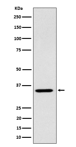 ARPC2 Rabbit mAb