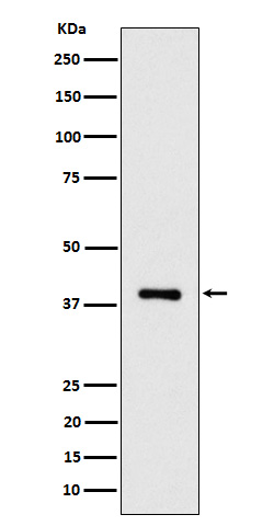 ACAT2 Rabbit mAb