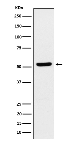 ZNF259 Rabbit mAb