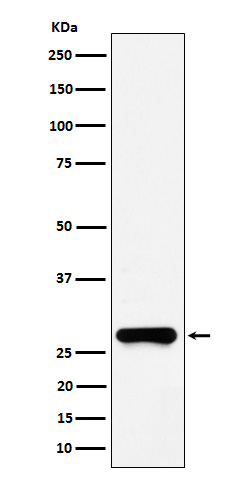 GSTO1 Rabbit mAb