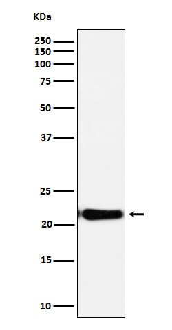 DNPH1 Rabbit mAb