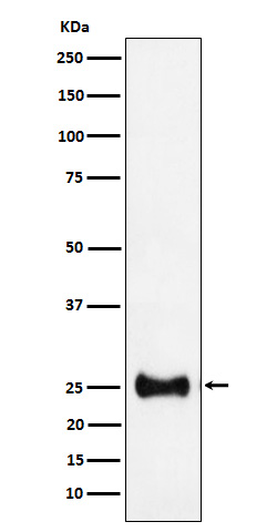 Adenylate kinase 4 Rabbit mAb