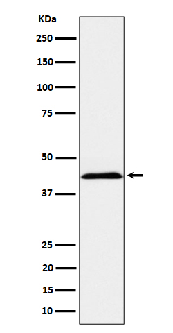 NCTR2 Rabbit mAb