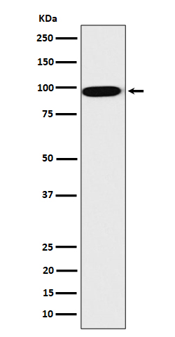 CLPTM1 Rabbit mAb