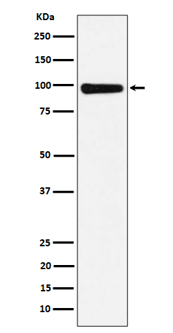 CHM Rabbit mAb