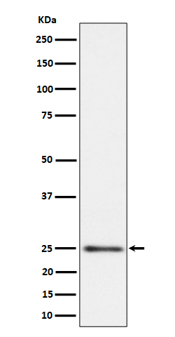 MRPS15 Rabbit mAb