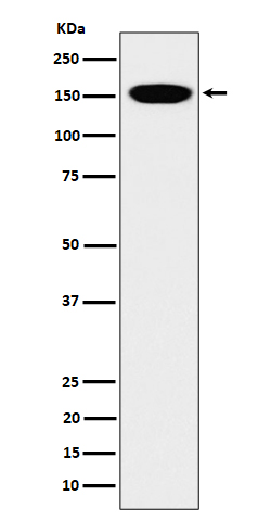 CNAP1 Rabbit mAb