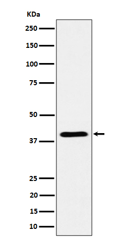 ADH4 Rabbit mAb