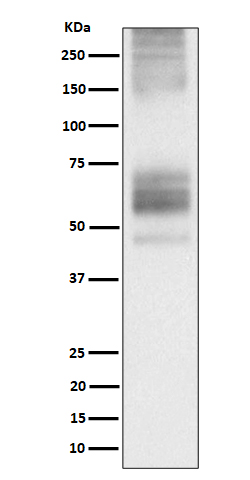 Somatostatin Receptor 1 Rabbit mAb