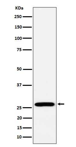 RPL13 Rabbit mAb