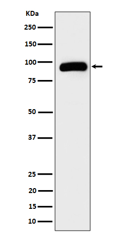 TRPV5 Rabbit mAb