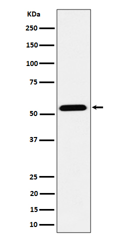 ENPP5 Rabbit mAb