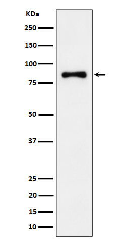 ALDH16A1 Rabbit mAb