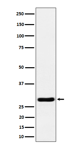 Calcipressin 1 Rabbit mAb