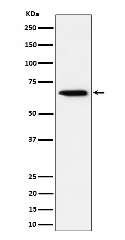 Sterol carrier protein 2 Rabbit mAb