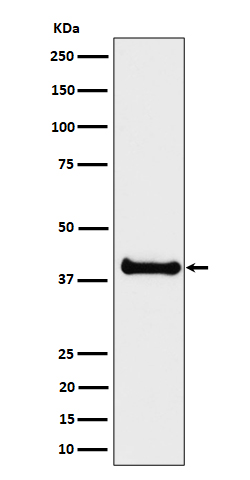 ALS2CR1 Rabbit mAb