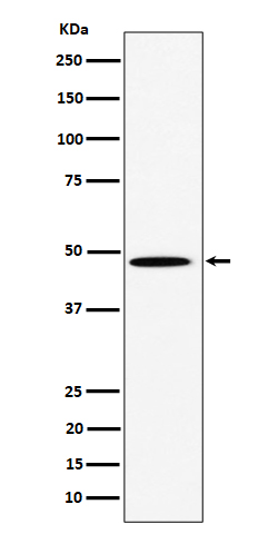 HIF Prolyl Hydroxylases Rabbit mAb