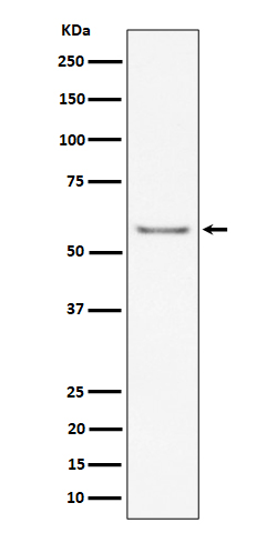 ICAM2 / CD102 Rabbit mAb