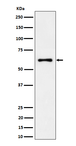 EYA2 Rabbit mAb