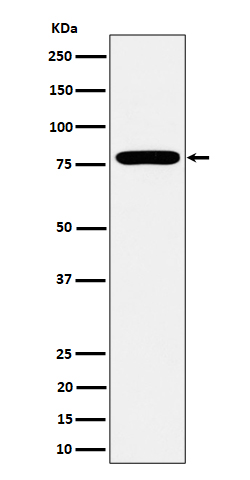 GFPT1 Rabbit mAb