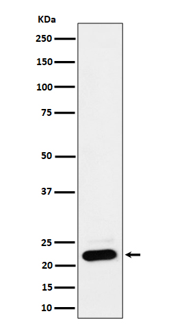 NDUFB9 Rabbit mAb