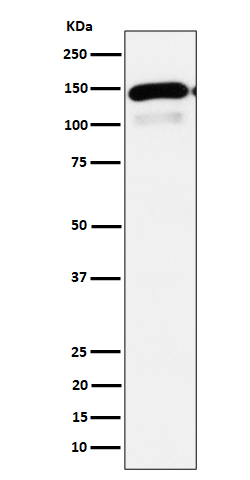 PLCB1 Rabbit mAb