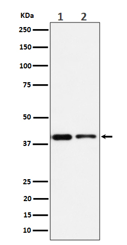 SLP2 Rabbit mAb