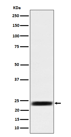 ARFRP1 / ARP  Rabbit mAb