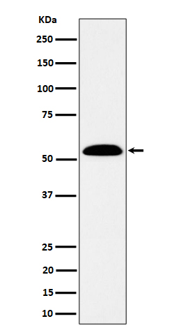 ALDH7A1 Rabbit mAb