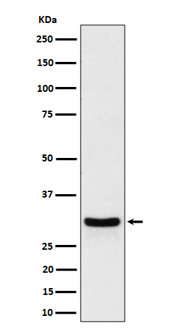 FRAT1 Rabbit mAb