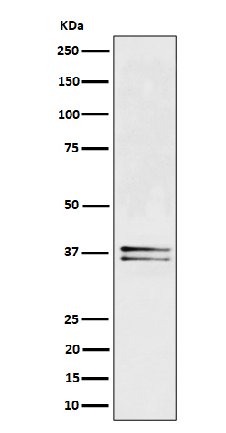 LAT Rabbit mAb