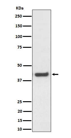 MVK Rabbit mAb