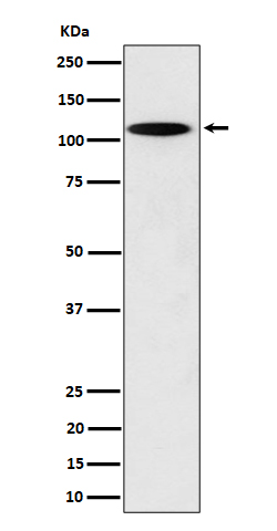 N4BP1 Rabbit mAb