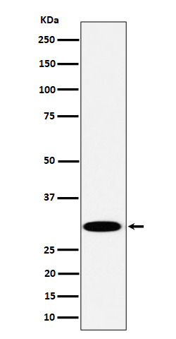 TPMT Rabbit mAb