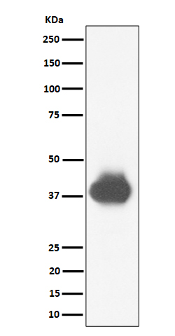 CD32A + CD32B + CD32C Rabbit mAb