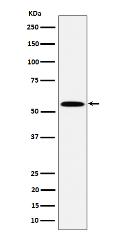 PNK / PNKP Rabbit mAb