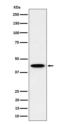 ITPK1 Rabbit mAb