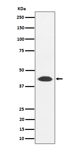 NUDT19 Rabbit mAb