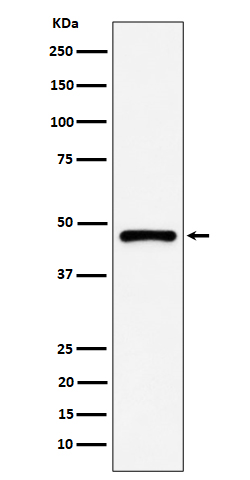 PSMC5 Rabbit mAb