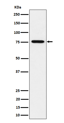 BRAT1 Rabbit mAb