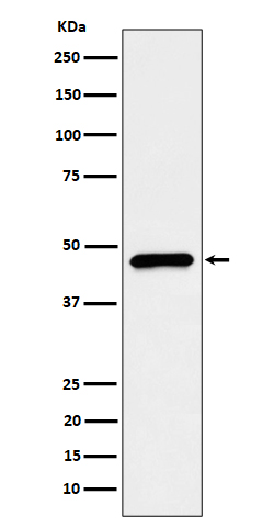 CECR5 Rabbit mAb