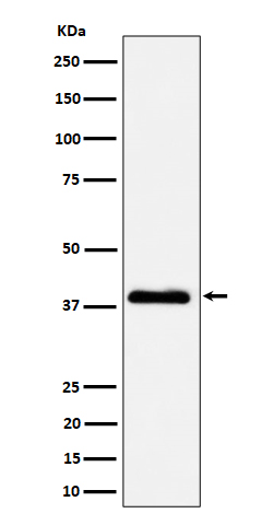 NSDHL Rabbit mAb