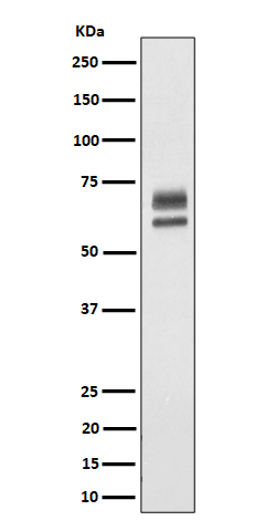 PPP2R5D Rabbit mAb