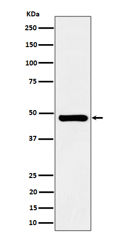 SNX5 Rabbit mAb