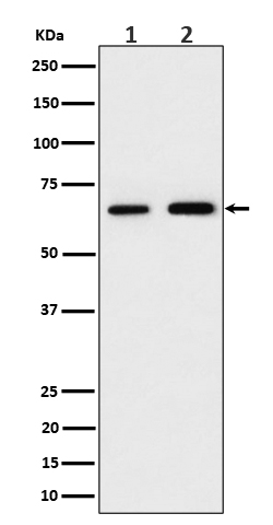 PGM1 Rabbit mAb